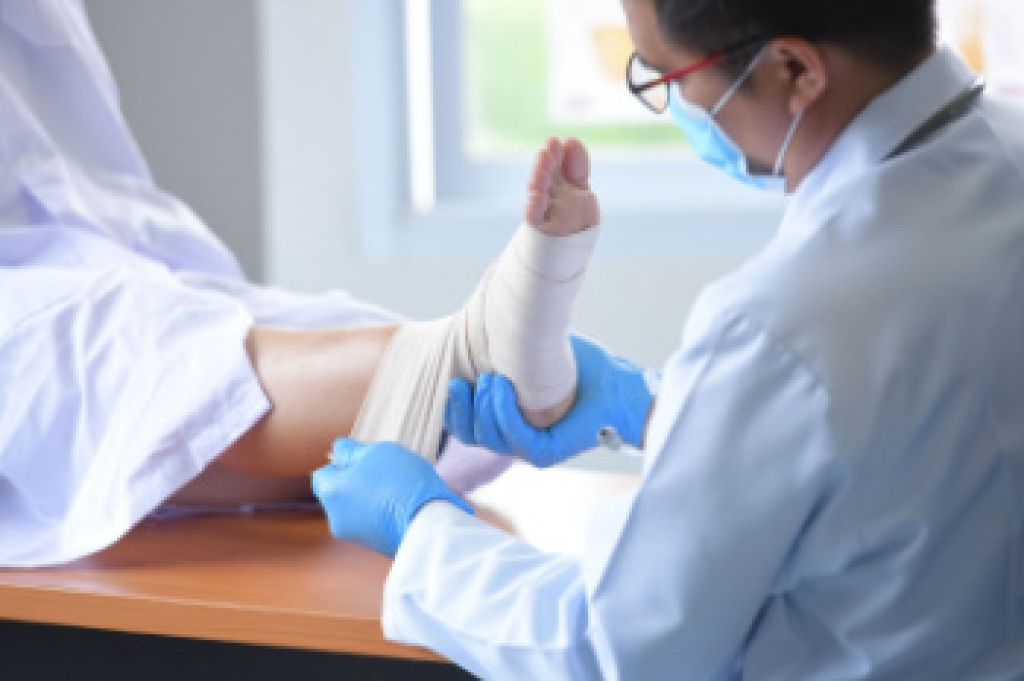 Broken Ankle Treatment and Recovery
