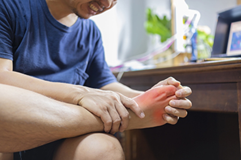How Gout Progresses and Affects Foot Health