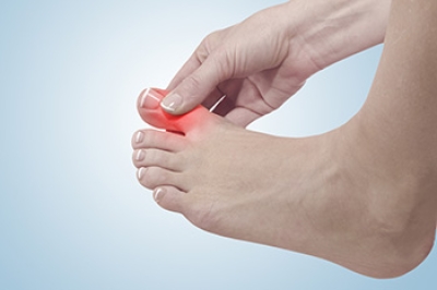 What Is Gout and Who Is at Risk?