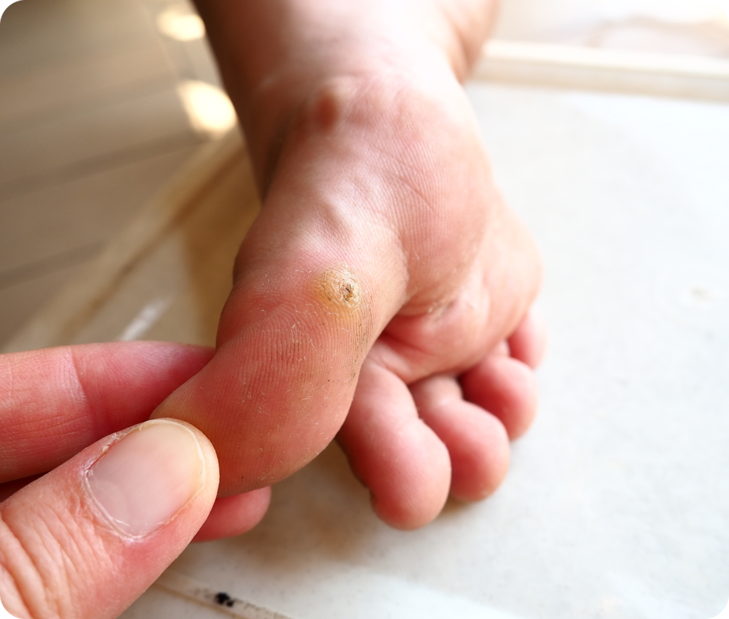 Skin, Nail and Fungal Treatments