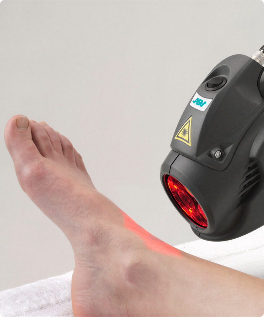 Therapy Laser for Pain