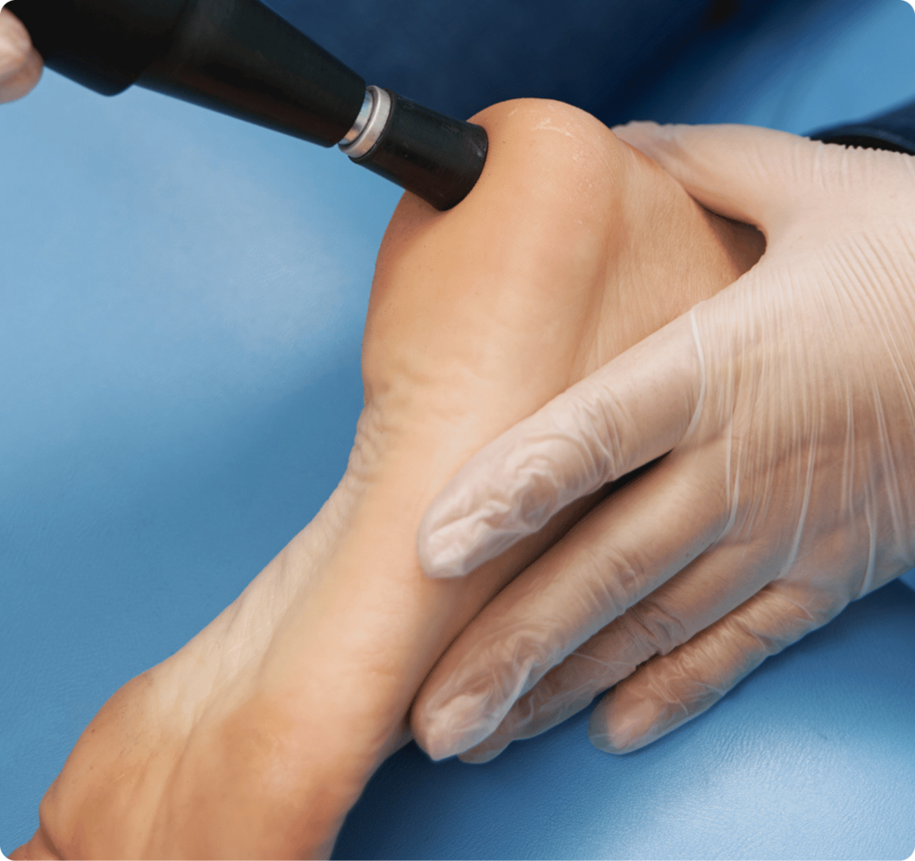 common source of foot pain